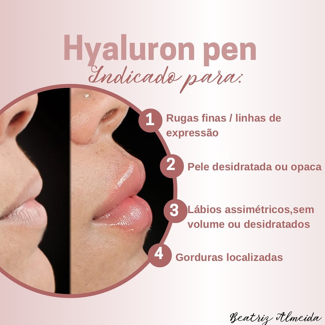 Hyaluron Pen